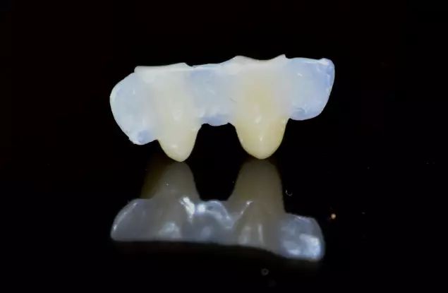 牙齿粘结修复容易出现哪些问题