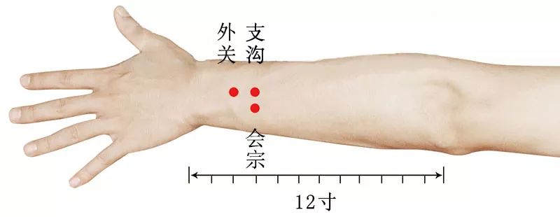 史上最全痛症針灸治療(七字歌訣 穴位圖解)_針刺