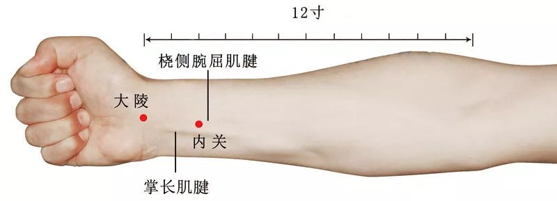 史上最全痛症針灸治療(七字歌訣 穴位圖解)_針刺