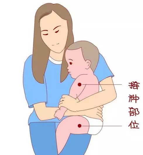 新生儿大腿注射示意图图片