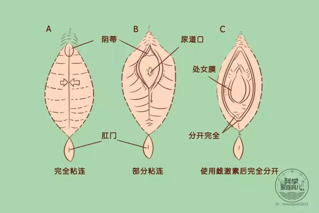 少数女宝宝可能到6,7岁阴唇还没分开,宝爸妈也无需着急,基本到青春期