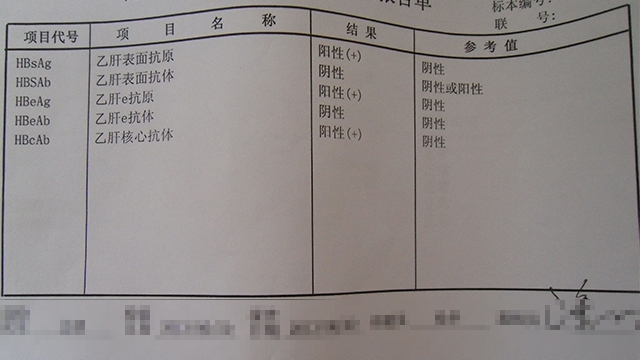 乙肝五項一三五陽性該隱瞞男友嗎乙肝會不會傳染伴侶