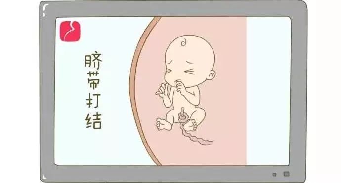 这个要命的结,让她和胎儿与死神擦肩而过