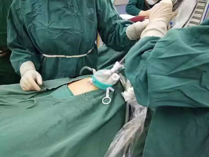 宫外孕手术过程图片