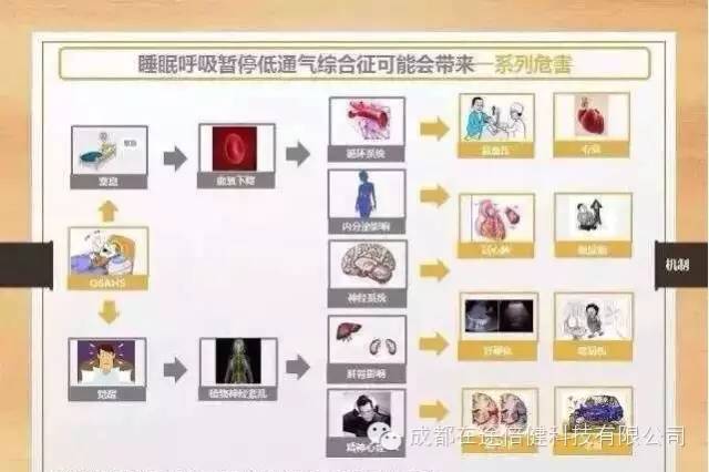 鼾症(osa)危害您知多少?