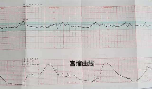 想提前知道自已分娩顺利否最后一次产检两个数据已告诉你答案