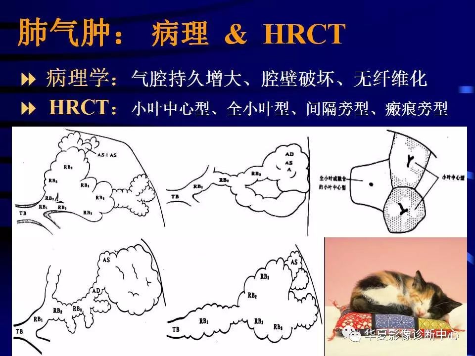 带你了解肺气肿的影像学分型及诊断