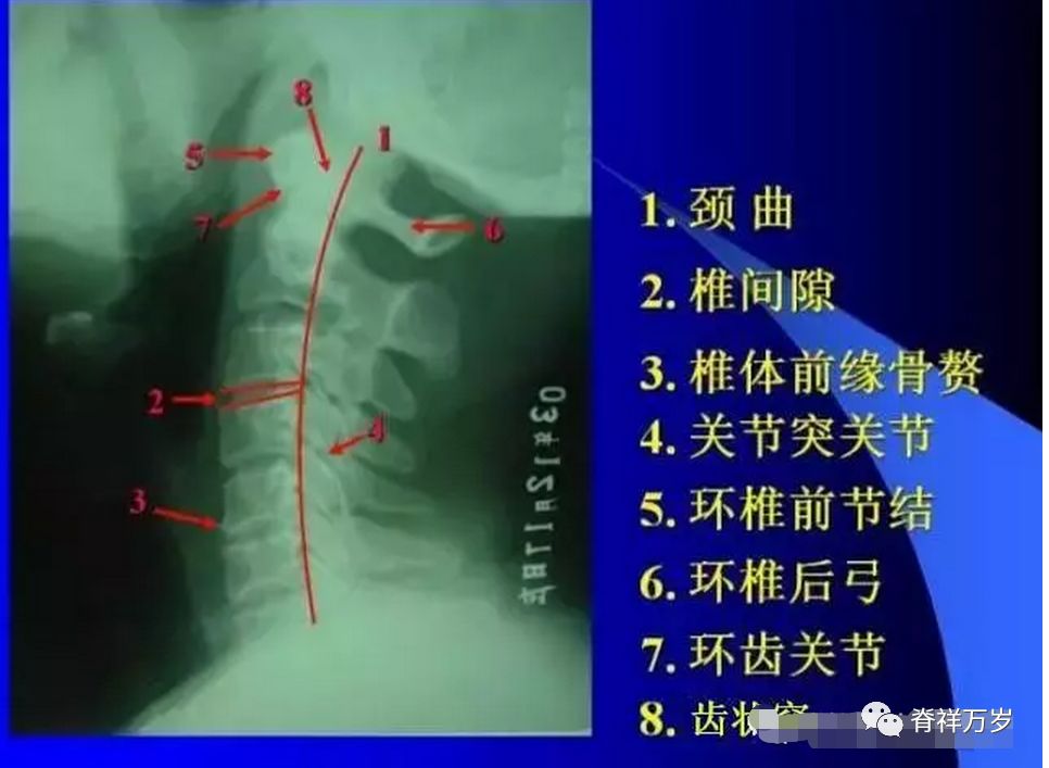 颈椎x线解剖图高清图片