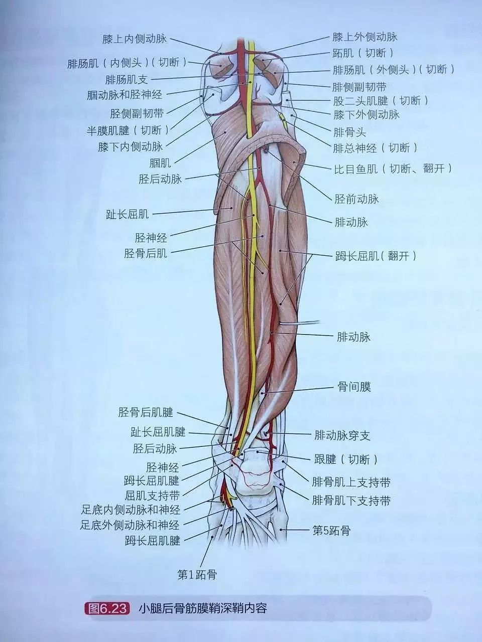 解剖回顾1  将小腿后骨筋膜鞘内的肌肉恢复至解剖位置 2