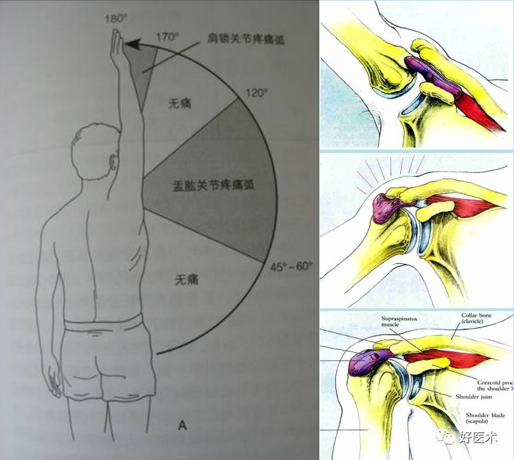 最全肩關節解剖及查體方法彙總速收藏