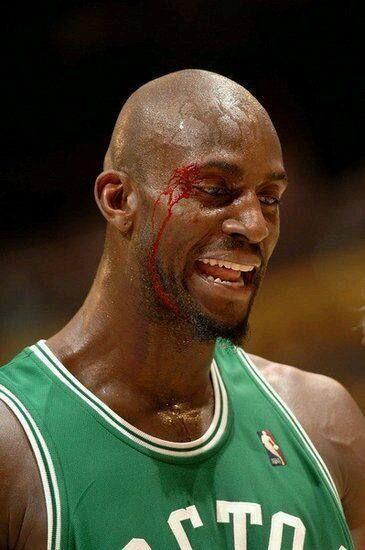 篮球恐怖受伤掉眼珠图片