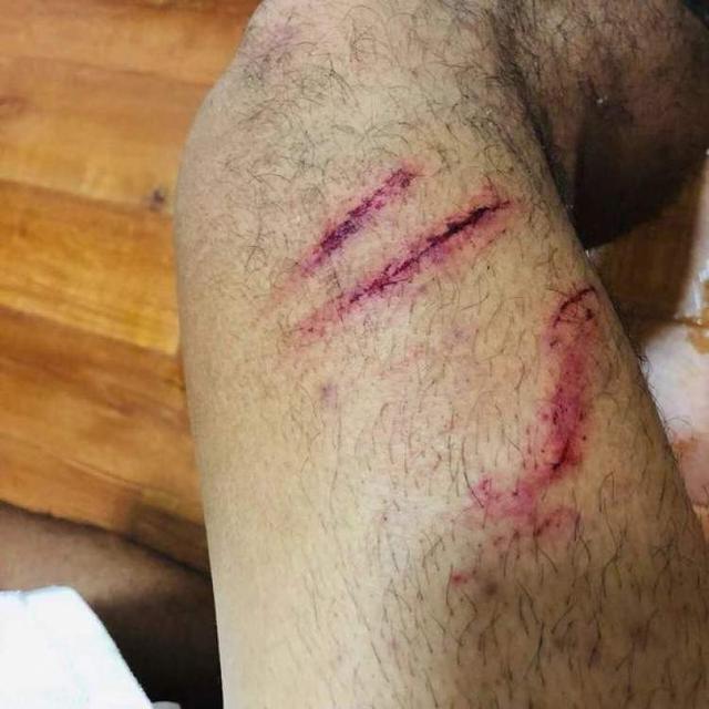 u23联赛半决赛太激烈,上港队长赛后晒双腿受伤图