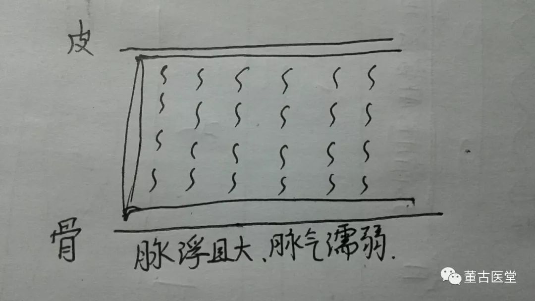 看图学脉诊,基础篇,浮脉