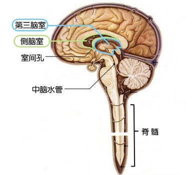 室间孔闭锁畸形