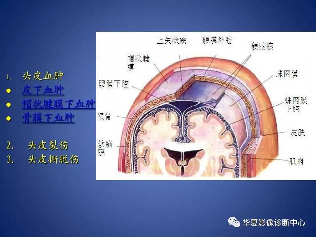 脑膜分层图片