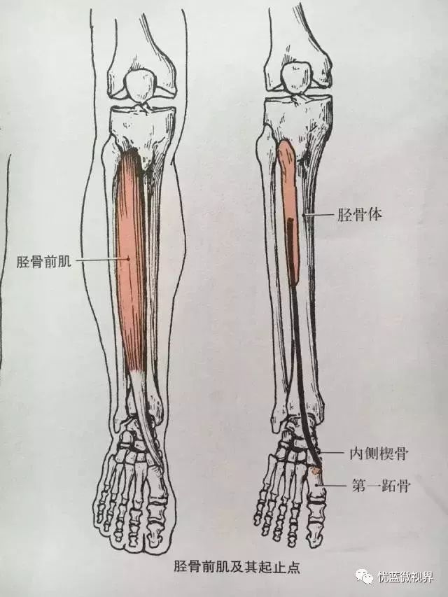 胫前肌腱位置图片图片