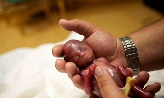 五个月大的胎儿图片图片