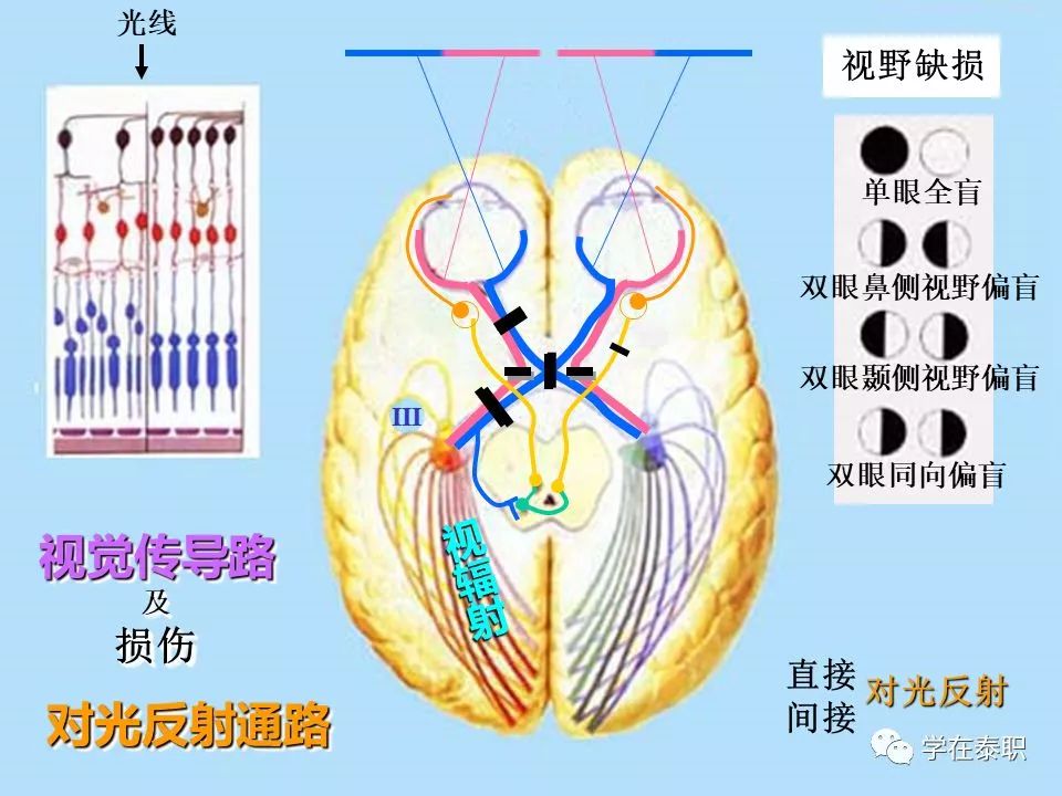 视觉传导通路示意图图片