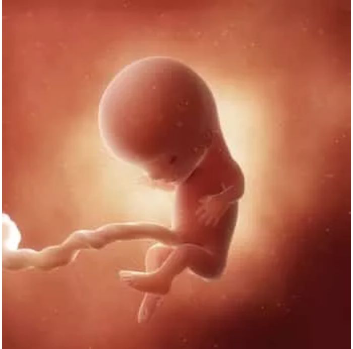孕11周的双胞胎胎儿发育图7070:孕11周的胎宝宝,大约像草莓一般