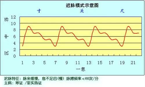 古代医学说喜脉到底什么样的古人把脉这几个小诀窍至关重要