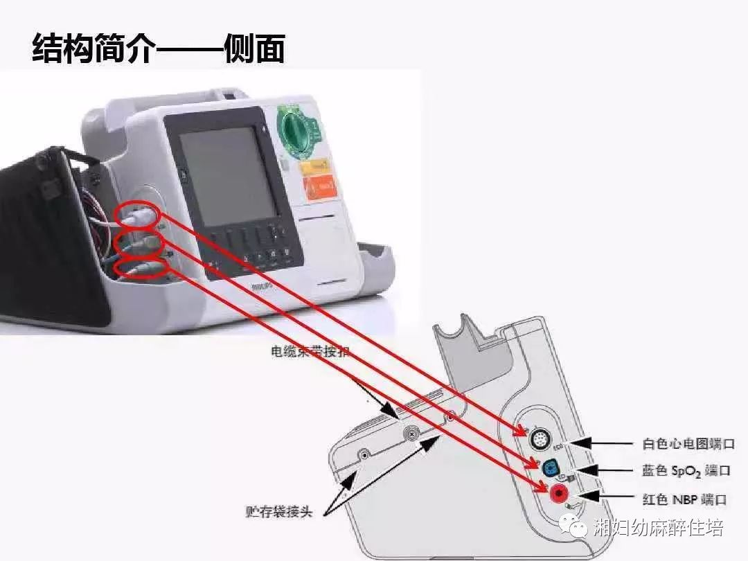 除颤仪结构图解图片