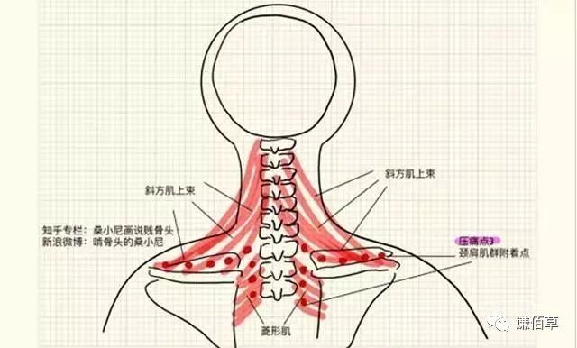 如果颈部在前屈,后伸,旋转和侧屈的活动时,感觉颈部不适,就是颈椎病在