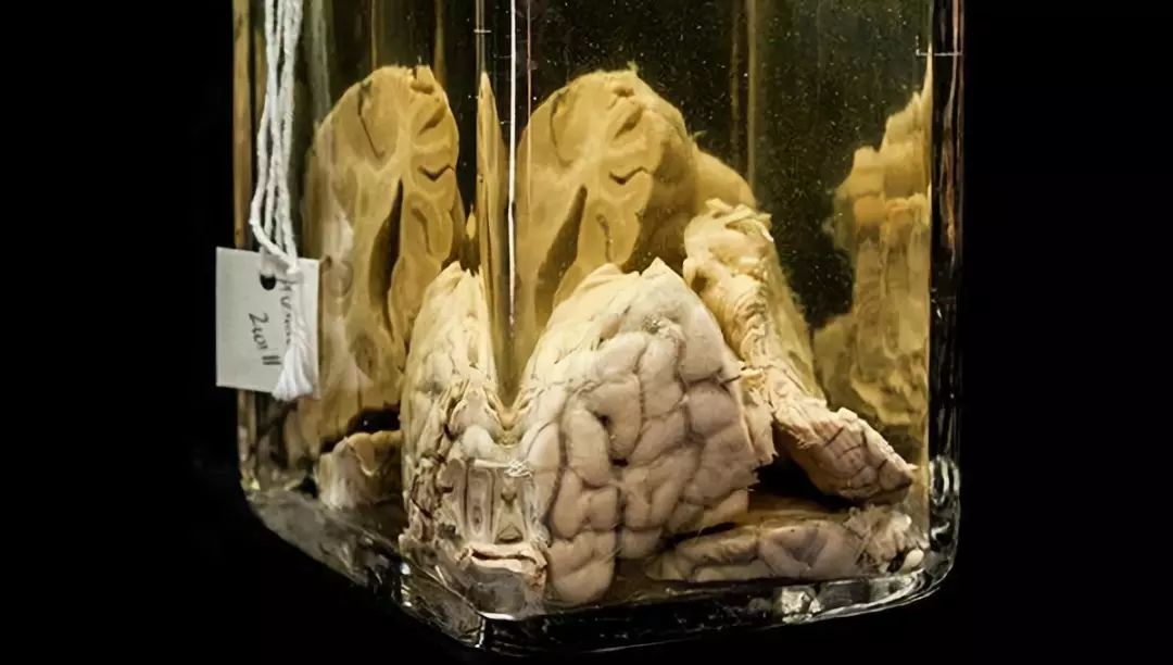 头盖骨,大脑切片,连体婴儿标本……逛医学博物馆不完全指南