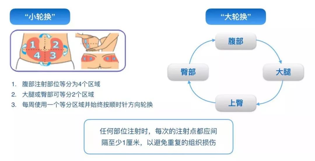 德谷胰岛素注射部位图片