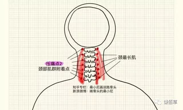 脖子有哪些部位图片图片