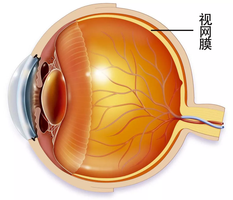 近视眼视网膜成像图图片