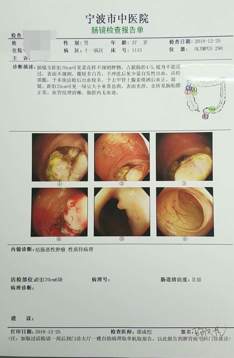 胃癌报告单图片高清图片