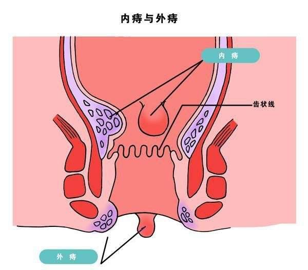 肛门点位分布图图片