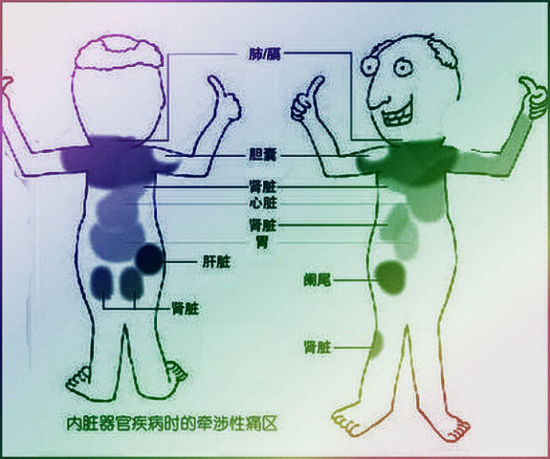 內臟器官對應疼痛圖走紅 被封