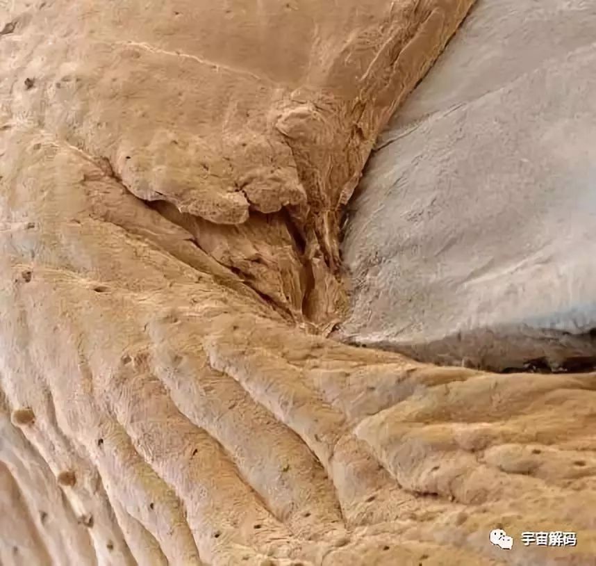 显微镜下的腋毛癣图片