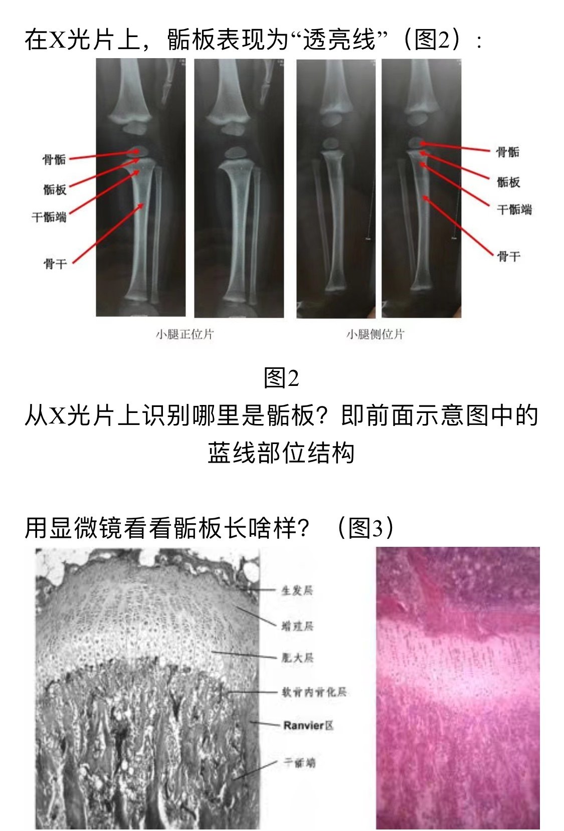 骺板 图解图片