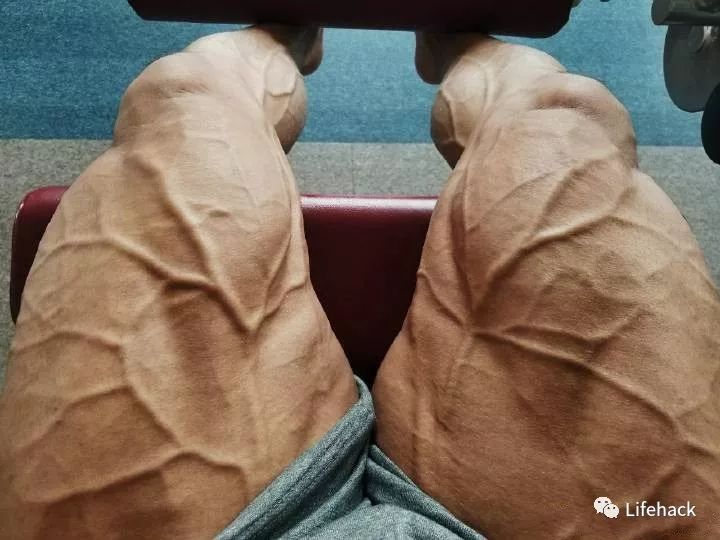 肌肉腿长什么样子图片图片