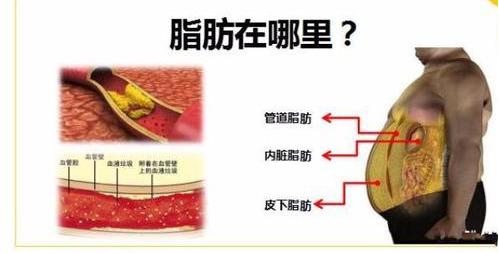 啤酒肚脂肪解剖图图片