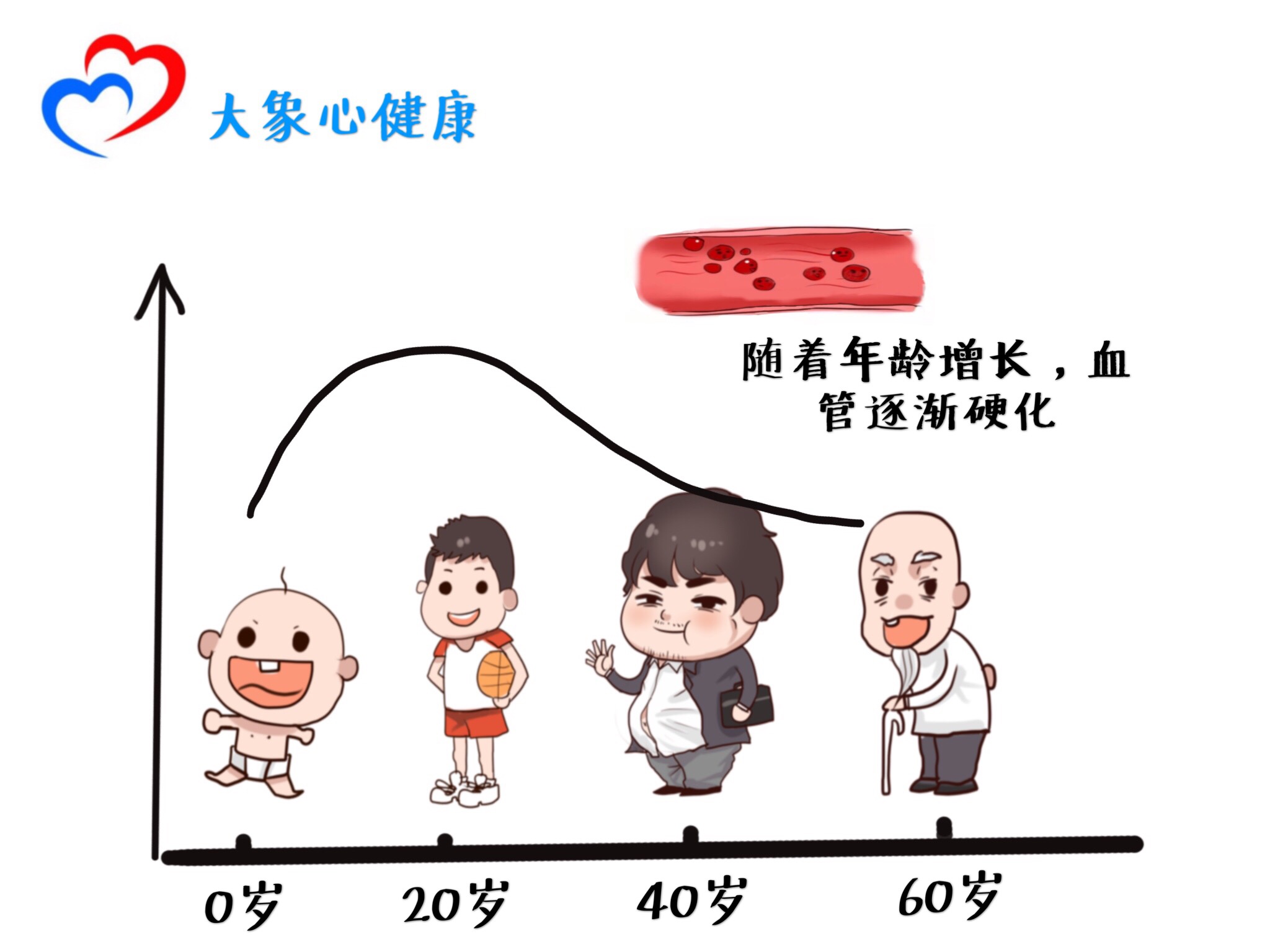 干货动脉硬化和动脉粥样硬化有什么区别