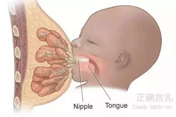 乳头裂开根部图片