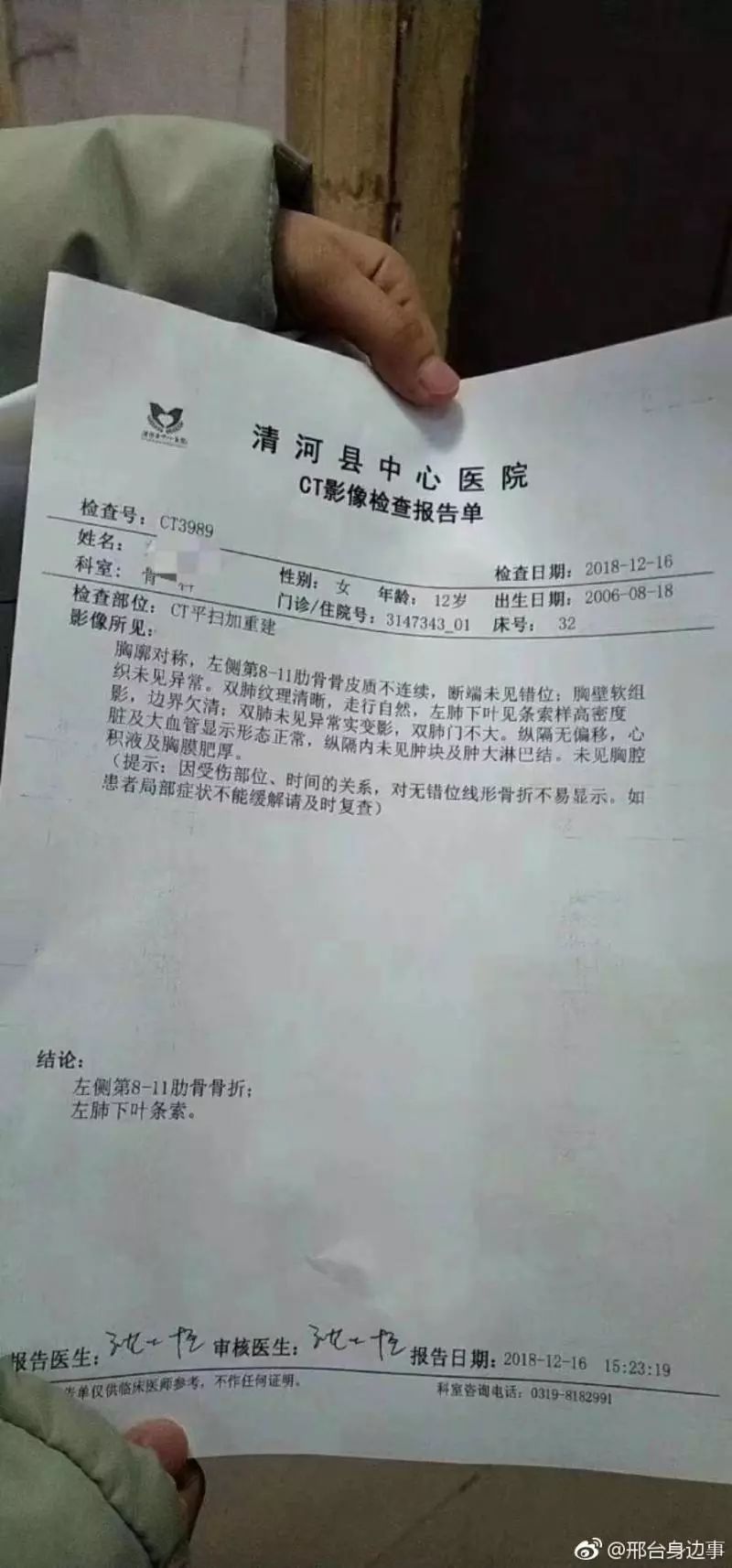 ct骨折报告图片