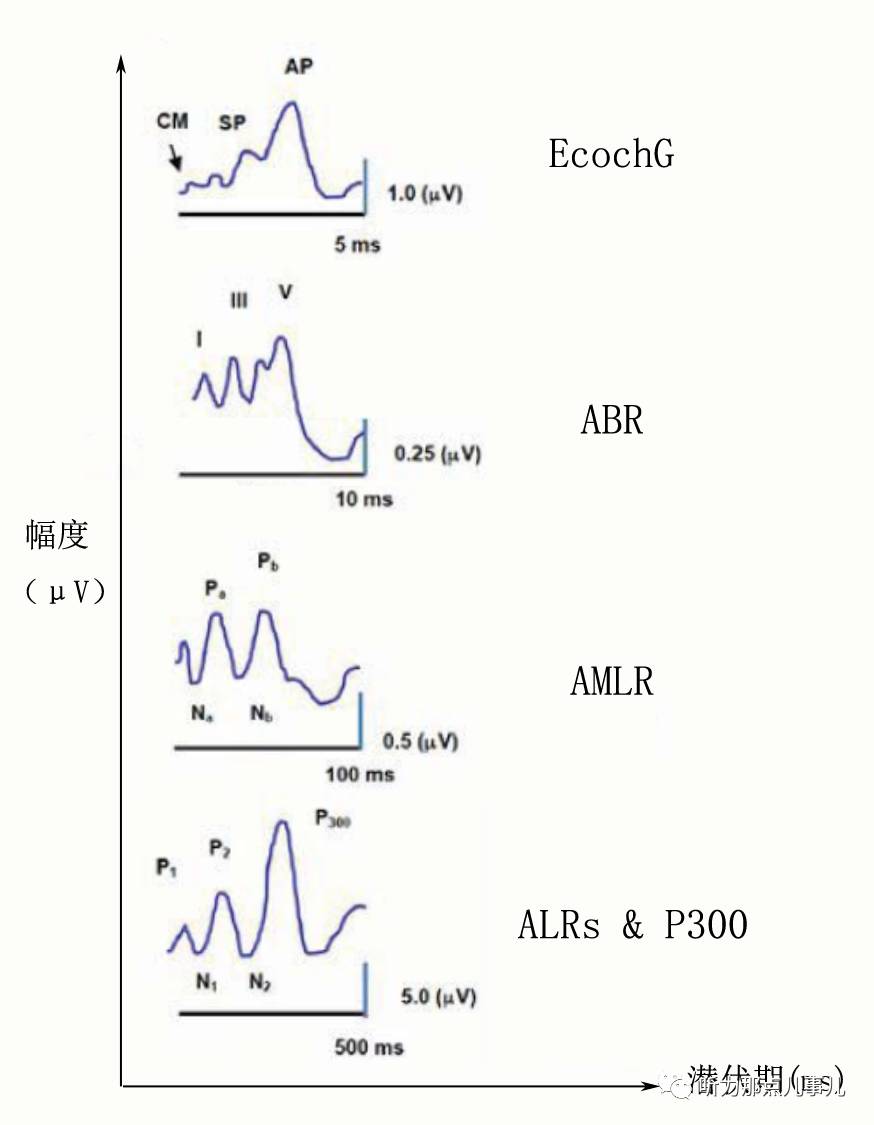 由上至下依次为耳蜗电图,听觉脑干诱发电位,中潜伏期反应,长潜伏期