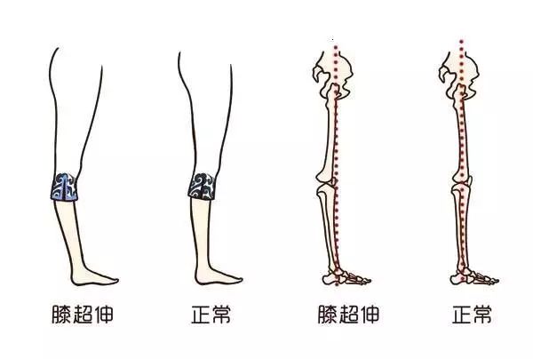 蜂腰什么膝成语_蜂腰鹤膝过峡束气图