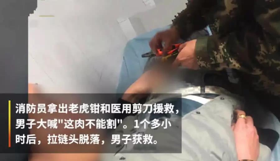 男子下边被夹住,求助医生解救自己,男子:这个肉不能割