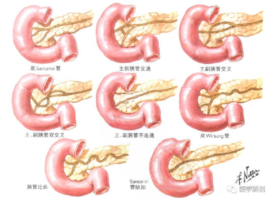 胰管及其变异解剖图谱