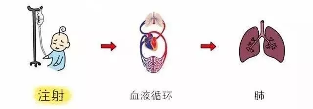 静脉注射循环过程图片