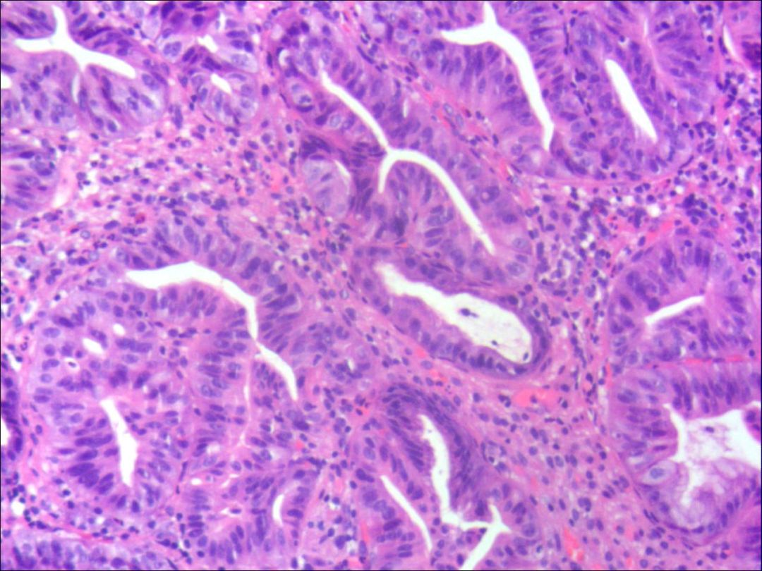 胃体浆细胞光镜图图片