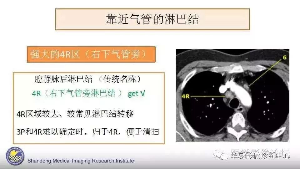 肋骨淋巴结图片