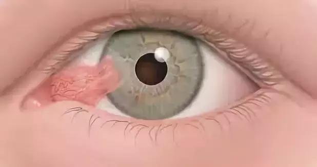眼结膜在哪个位置图片图片
