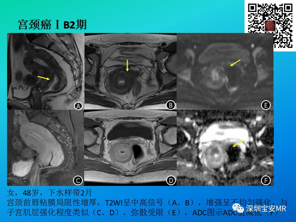 神經根成像,心肌灌注成像,乳腺及前列腺動態灌注增強成像等諸多功能