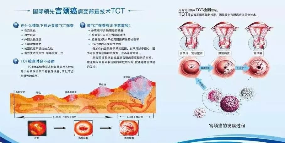 存在一定的漏診率,可以達到15%左右,宮頸腺癌的漏診率比鱗癌更高一點